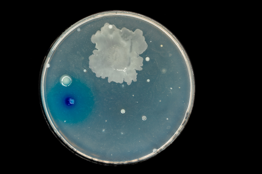 petridish-bacteriagrowth
