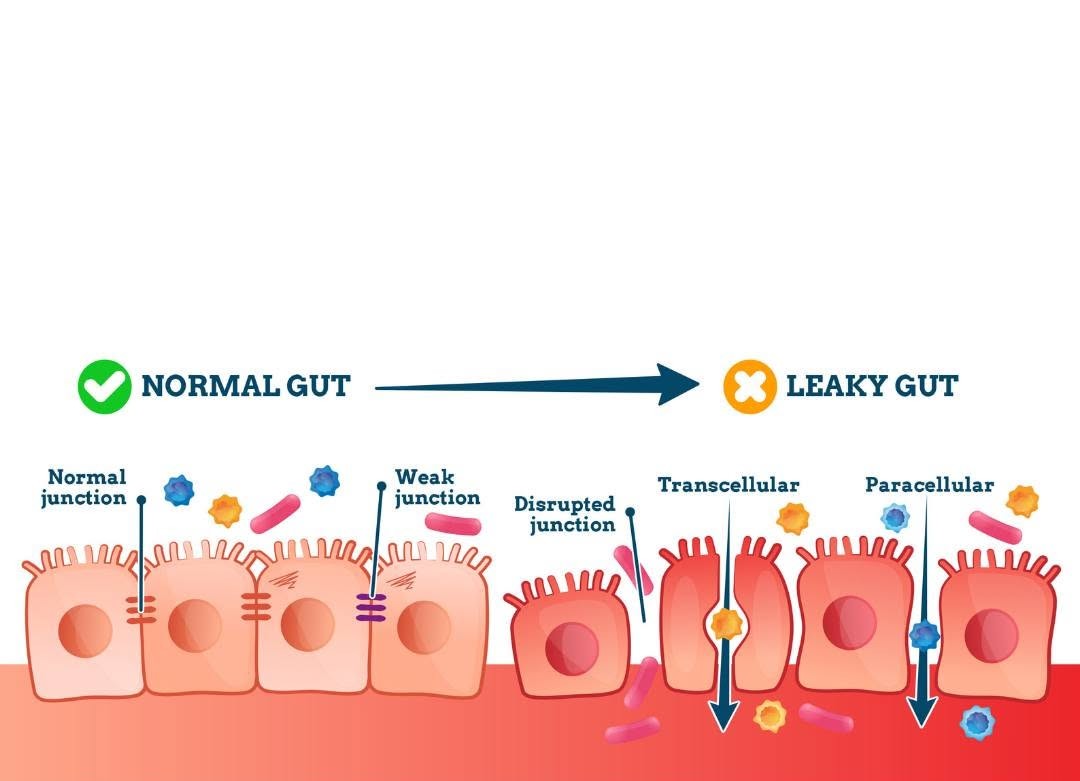 Normal and Leaky Gut and Mycotoxins Normal and Leaky Gut and Mycotoxins